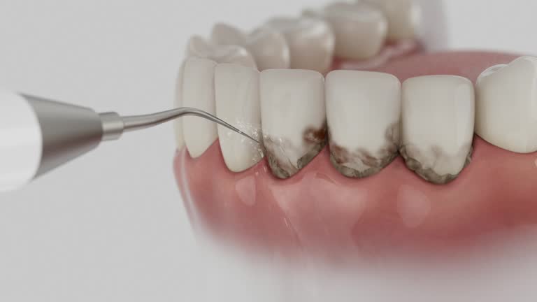 Trusted Teeth Cleaning And Checkup service in Dacula, GA - Dentist Open Now